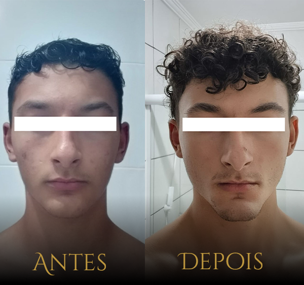 Crânio Primal - Resultados