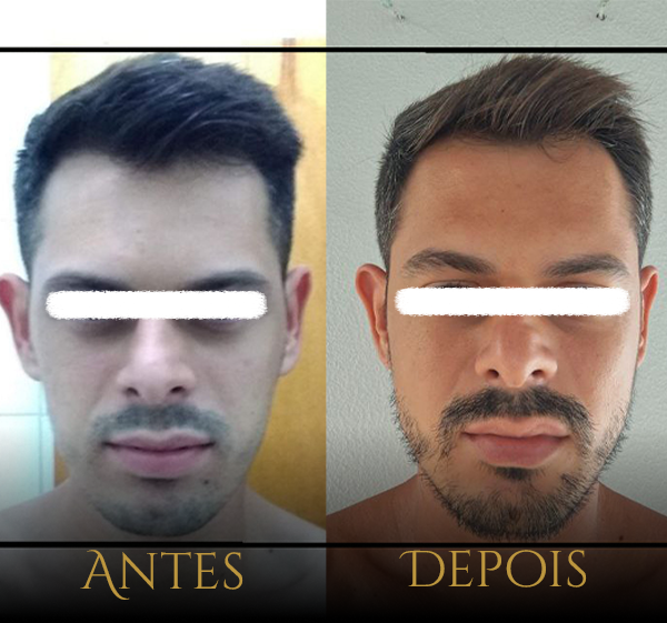 Crânio Primal - Resultados