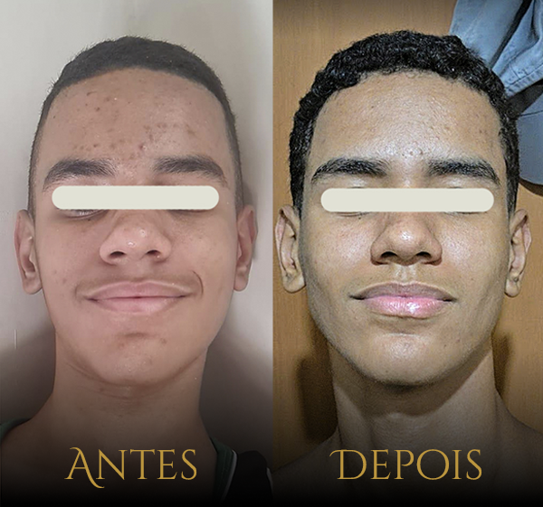Crânio Primal - Resultados