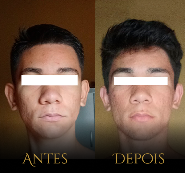Crânio Primal - Resultados